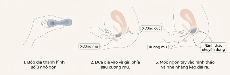 3 bước cơ bản để đặt đĩa nguyệt san